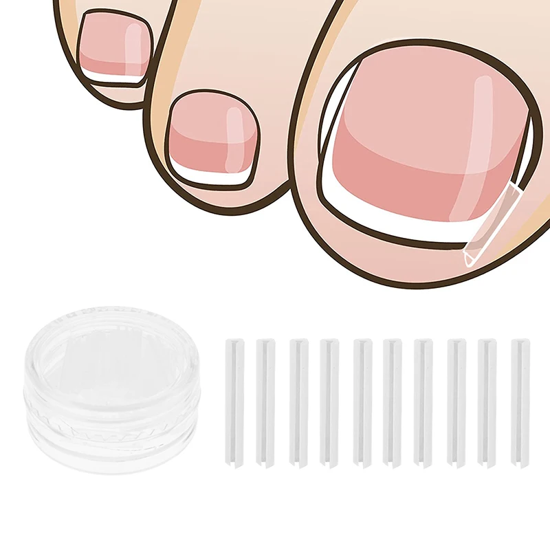 50Pcs Toenail Straightening Clip Ingrown Toenail Correction Tool Nail Treatment Elastic Patch Sticker Foot Care Pedicure
50Pcs Toenail Straightening Clip Ingrown Toenail Correction Tool Nail Treatment Elastic Patch Sticker Foot Care Pedicure