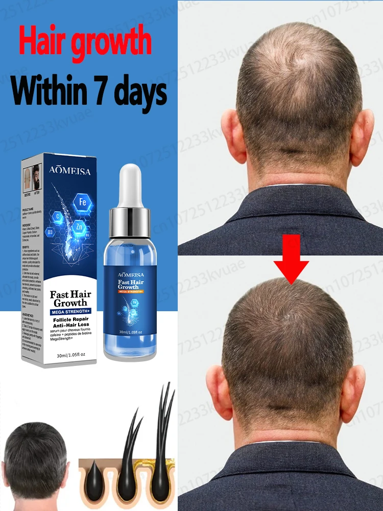 Fast Hair Growth Hair Growth Oil Effective Baldness Repair Hereditary Hair Loss Postpartum Hair Loss Seborrheic Hair Anti Loss
Fast Hair Growth Hair Growth Oil Effective Baldness Repair Hereditary Hair Loss Postpartum Hair Loss Seborrheic Hair Anti Loss