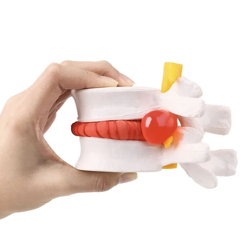 

Medical props model Anatomical Spine Lumbar Disc Herniation Anatomy Medical Teaching Tool