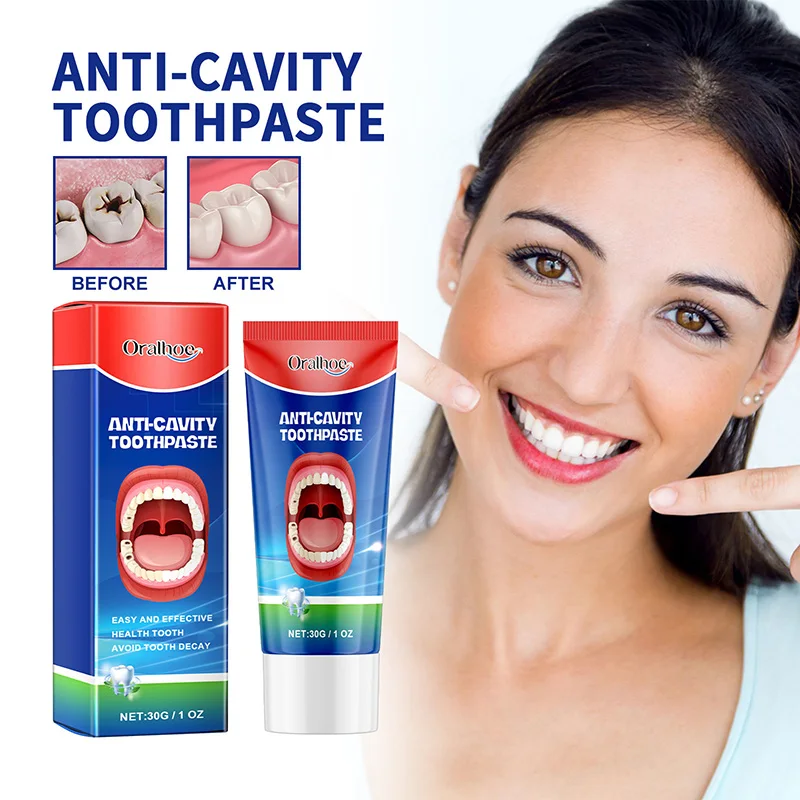 

Зубная паста против кариеса, восстанавливающий крем для кариеса, Предотвращает кариес, защищает зубы, 30 г
