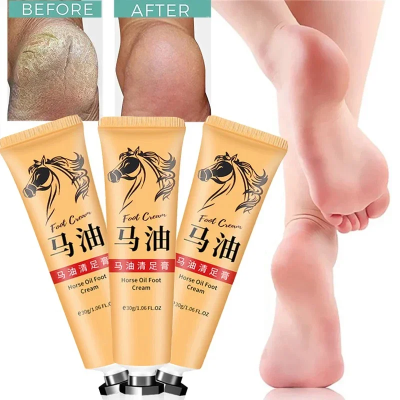 Anti-beriberi Foot Care Cream Winter Anti-chapped Moisturizing Foot Cream Repair Cracked Heel Remove Dead Skin Horse Oil Cream
Anti-beriberi Foot Care Cream Winter Anti-chapped Moisturizing Foot Cream Repair Cracked Heel Remove Dead Skin Horse Oil Cream