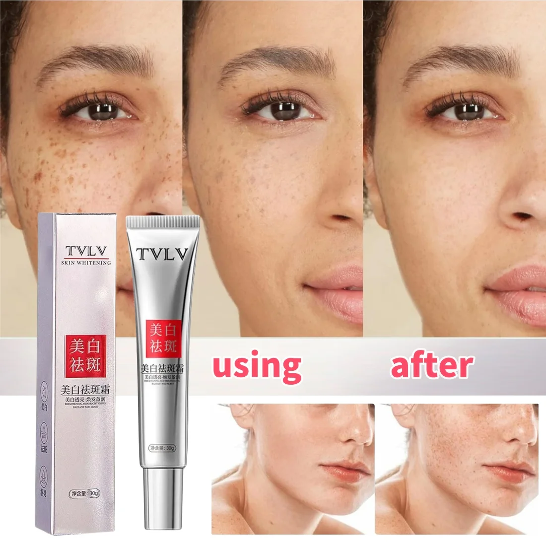 

Niacinamide Freckles Whitening Face Cream Fade Dark Spots Improve Dullness Pigment Corrector Brightening Nourishing Skincare 30g