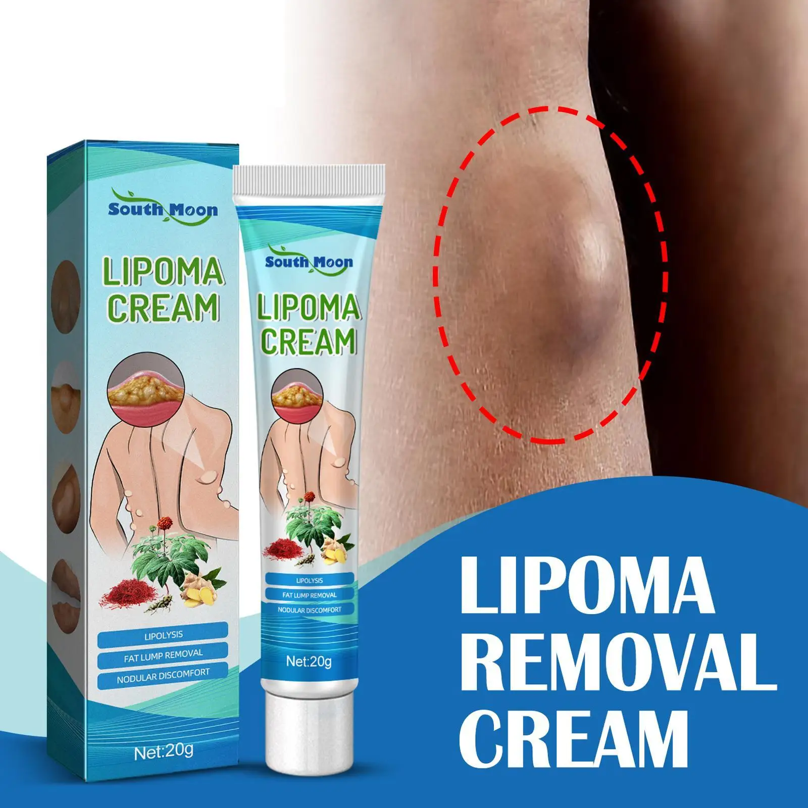 Delipidation Cream Lipoma Treatment Cream Lipolysis Removal Skin Swelling Cellulite Ointment Tumor Exfoliating Pain Relief 2022
Delipidation Cream Lipoma Treatment Cream Lipolysis Removal Skin Swelling Cellulite Ointment Tumor Exfoliating Pain Relief 2022