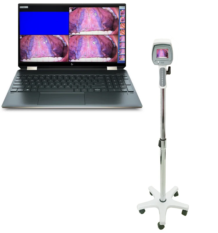 Hot selling gynecological self-checking endoscope digital portable electronic colposcope
Hot selling gynecological self-checking endoscope digital portable electronic colposcope