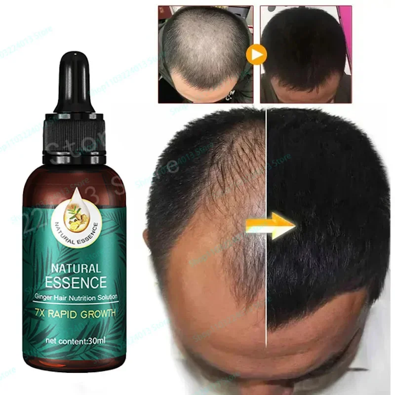 

Fast Hair Growth Ginger Growth Hair Oil Treatment Anti Hair Loss Men Women Scalp Treatment Serum Products Beauty Health