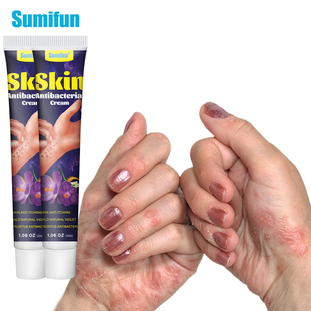 30g Sumifun Psoriasis Cream Eczema Ointment Treatment Hand Tinea Foot Odor Versicolor Inhibit Dermatitis Fungus Anti-itch Cream
30g Sumifun Psoriasis Cream Eczema Ointment Treatment Hand Tinea Foot Odor Versicolor Inhibit Dermatitis Fungus Anti-itch Cream