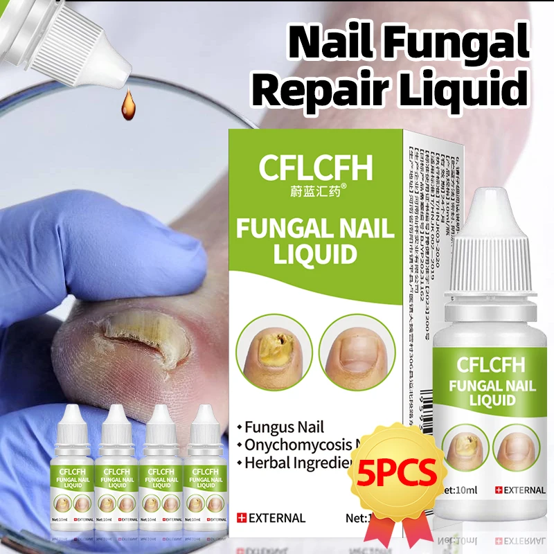 Fungal Nail Treatment Liquid Onychomycosis Nail Repair Paronychia Anti Infection Cleaner Toe Fungus Removal Solution Foot Care
Fungal Nail Treatment Liquid Onychomycosis Nail Repair Paronychia Anti Infection Cleaner Toe Fungus Removal Solution Foot Care
