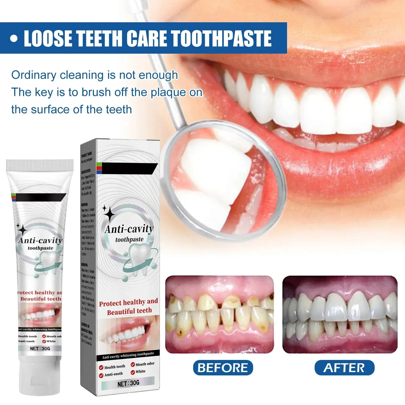 New Quick Repair of Cavities Caries Removal of Plaque Stains Decay Whitening Yellowing Repair Teeth Teeth Whitening
New Quick Repair of Cavities Caries Removal of Plaque Stains Decay Whitening Yellowing Repair Teeth Teeth Whitening