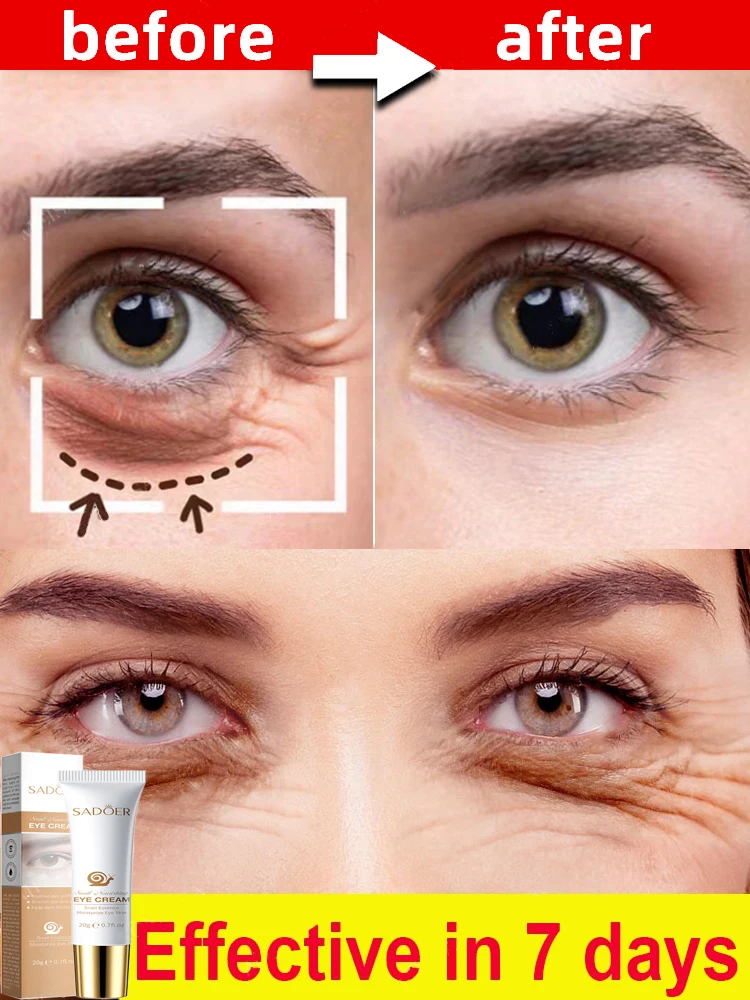 Buy5 get5 off Anti-Wrinkle Eye Cream Dark Circles Remove Eye Bags Puffy Eyes Reduce Wrinkles Fine Lines Remover Fat Particles
Buy5 get5 off Anti-Wrinkle Eye Cream Dark Circles Remove Eye Bags Puffy Eyes Reduce Wrinkles Fine Lines Remover Fat Particles