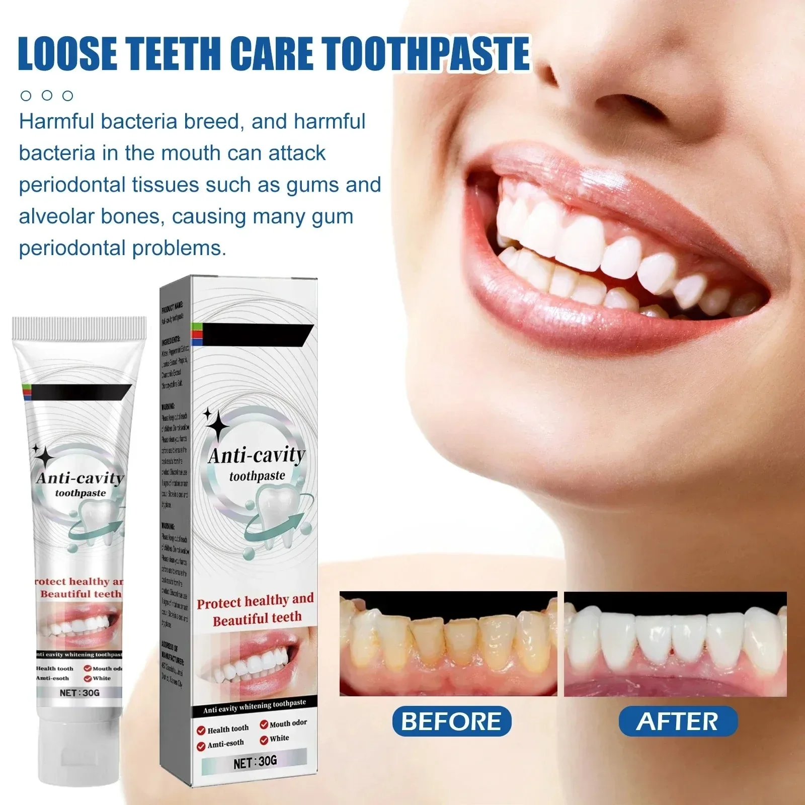 LOOSE TEETH CARE TOOTHPASTE,Remover dental calculus, whitening teeth,breath Preventing Periodontitis teeth whitening kit
LOOSE TEETH CARE TOOTHPASTE,Remover dental calculus, whitening teeth,breath Preventing Periodontitis teeth whitening kit