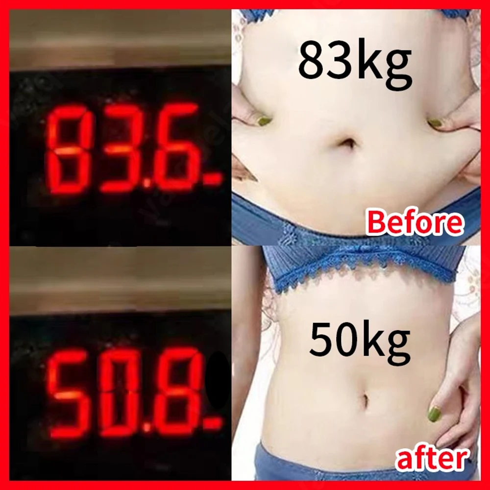 30PCS New Navel Fat Burning Patch Improve Stomach Discomfort Belly Slimming Products Chinese Medicine Lose Weight Stickers
30PCS New Navel Fat Burning Patch Improve Stomach Discomfort Belly Slimming Products Chinese Medicine Lose Weight Stickers