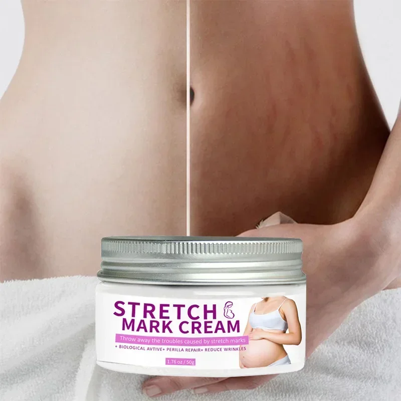 

Sdattor Removes Stretch Mark Cream To Remove Postpartum Obesity Pregnant Women Repair Anti-Aging Anti-Winkles Firming Body Skin