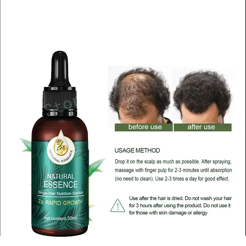 Ginger Hair Growth Spray Strengthening-Hair Massage Scalp Dense-Hair Strengthening Hair Loss Prevention Repair Nourishing Liquid
Ginger Hair Growth Spray Strengthening-Hair Massage Scalp Dense-Hair Strengthening Hair Loss Prevention Repair Nourishing Liquid