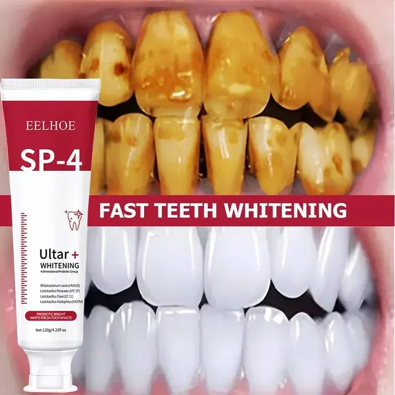 

Sdottor New Probiotic Caries Toothpaste SP 4 Whitening Tooth Decay Repair Paste Teeth Cleaner Plaque Remover Fresh Breath Dental
