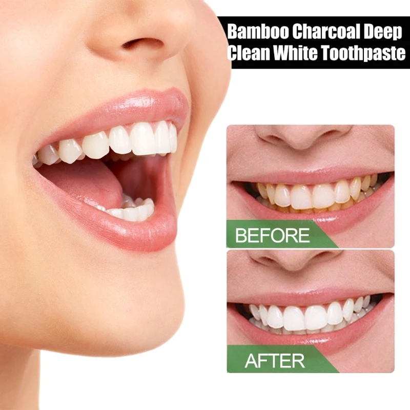 Y1UF Toothpaste Bamboo Charcoal Mint Flavor Hygiene Cleaning Remove Tooth Teeth Whitening Teeth Cleaning Toothpaste
Y1UF Toothpaste Bamboo Charcoal Mint Flavor Hygiene Cleaning Remove Tooth Teeth Whitening Teeth Cleaning Toothpaste