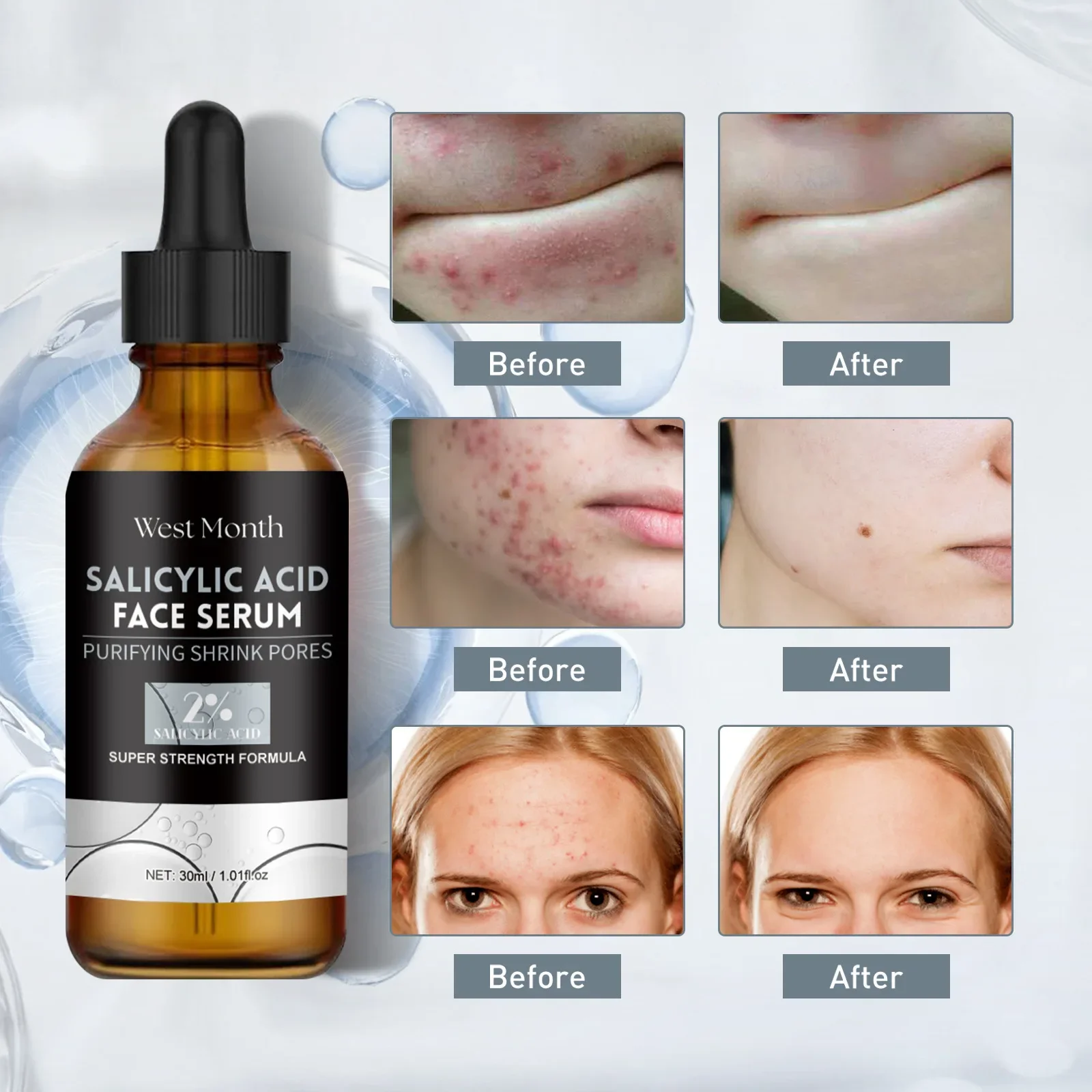 West Month Salicylic Acid Face Serum 30ml Acne Treatment Serum for Face Fades Dark Spots & Scars, Moisturizing & Hydrating Skin
West Month Salicylic Acid Face Serum 30ml Acne Treatment Serum for Face Fades Dark Spots & Scars, Moisturizing & Hydrating Skin