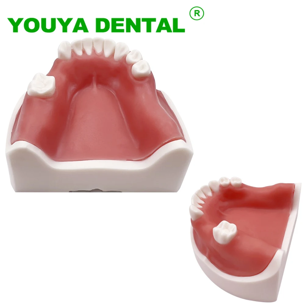 

Dental Teeth Model Jaw Implant Practice Demo Typodont Soft Gum Study Teaching Training Oral Model Dentistry Demonstration Tools