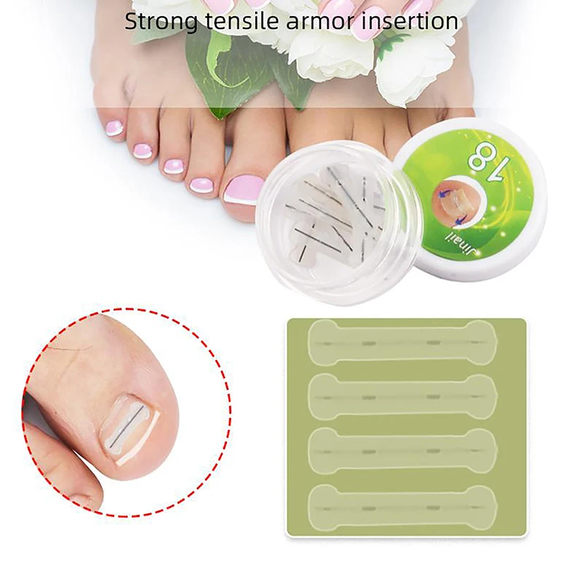 10pcs Ingrown Toenail Correction Tool Ingrown Toe Nail Treatment Elastic Patch Sticker Straightening Clip Brace Pedicure Tool
10pcs Ingrown Toenail Correction Tool Ingrown Toe Nail Treatment Elastic Patch Sticker Straightening Clip Brace Pedicure Tool