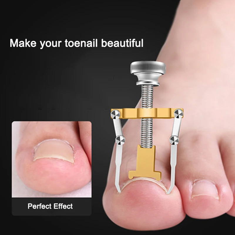 

Ingrown Toenail Toe Fixer Recover Correction Device Pedicure Foot Nail Care Tool Straightening Clip Brace corrector Easy to Use