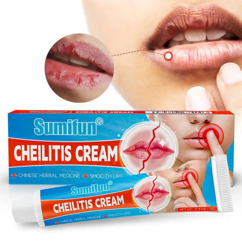 

20g Cheilitis Treatments Cream Inflammation Labial Herpes Antibacterial Ointment Chapped Lips Wrinkles Rehydration Lipstick