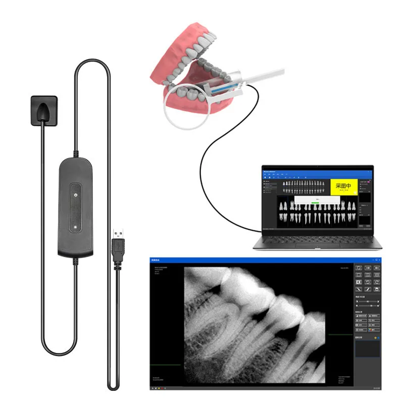 Dentistry Digital cameras Dental Sensor X-Ray High-Frequency Rx Digital Intraoral Digital System H D Image Radiovisografo
Dentistry Digital cameras Dental Sensor X-Ray High-Frequency Rx Digital Intraoral Digital System H D Image Radiovisografo