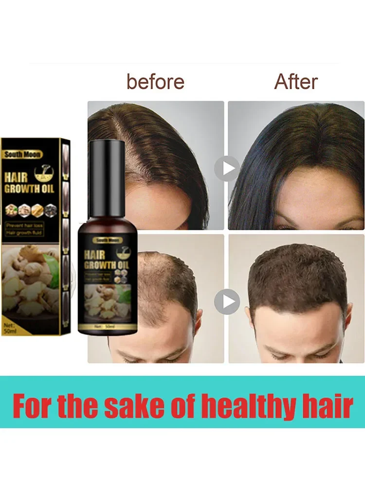 Improving hair health. Anti hair loss spray anti hair loss hair nutrition growth agent essence promotes hair growth
Improving hair health. Anti hair loss spray anti hair loss hair nutrition growth agent essence promotes hair growth