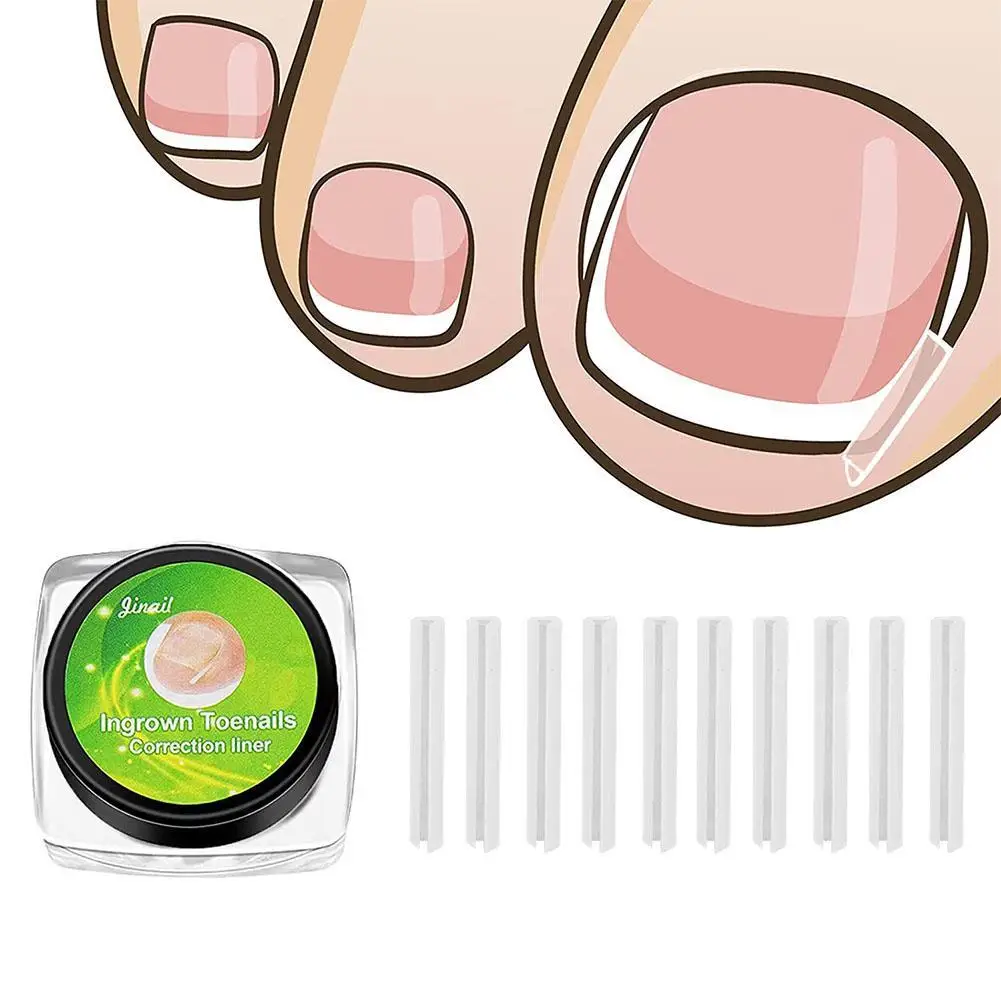 10/20pcs Ingrown Toenail Correction Tool Treatment Elastic Patch Sticker Straightening Clip Brace Pedicure Feet Care Pedicure
10/20pcs Ingrown Toenail Correction Tool Treatment Elastic Patch Sticker Straightening Clip Brace Pedicure Feet Care Pedicure