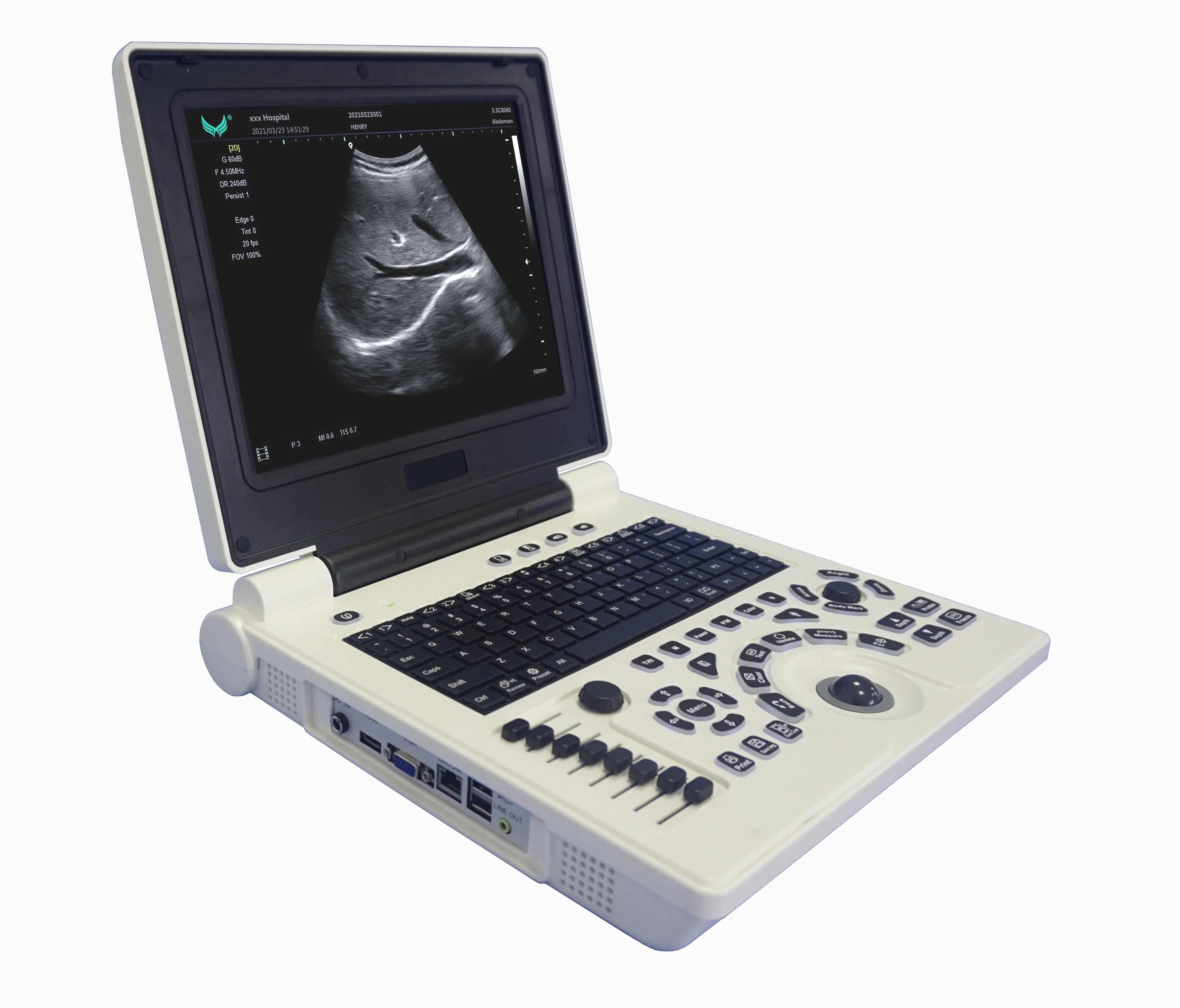 

Cheap BW ultrasound scanner with THI PW 3D for human or Veterinary software optional