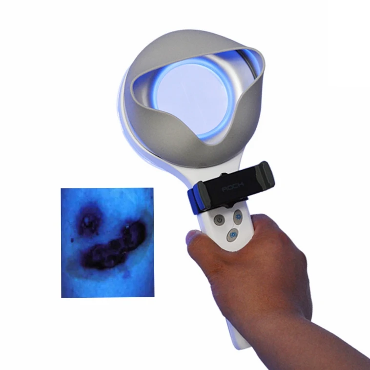 KN-9000B portable LED dermatology examination Woods Lamp medical magnifier skin multifuncional corporal ادوات قياس الدهون
KN-9000B portable LED dermatology examination Woods Lamp medical magnifier skin multifuncional corporal ادوات قياس الدهون