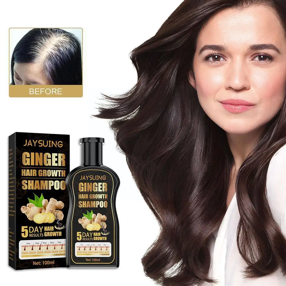 Hair Shampoo For Hair Growth And Hair Loss Prevents Scalp Treatments Thinning Hair For Men And Women 100ml S4A6
Hair Shampoo For Hair Growth And Hair Loss Prevents Scalp Treatments Thinning Hair For Men And Women 100ml S4A6