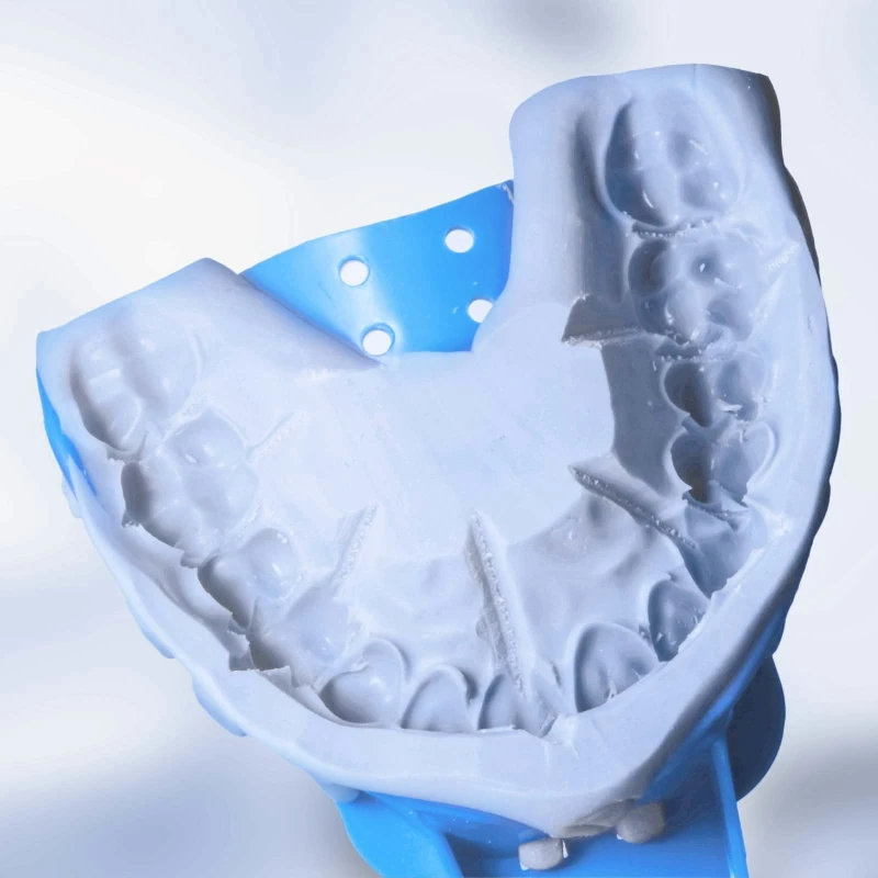 10x Disposable Dental for impression Trays Autoclave Perforated Trays Dental Accessory Tool Teeth Whitening Dentist Supp 
10x Disposable Dental for impression Trays Autoclave Perforated Trays Dental Accessory Tool Teeth Whitening Dentist Supp