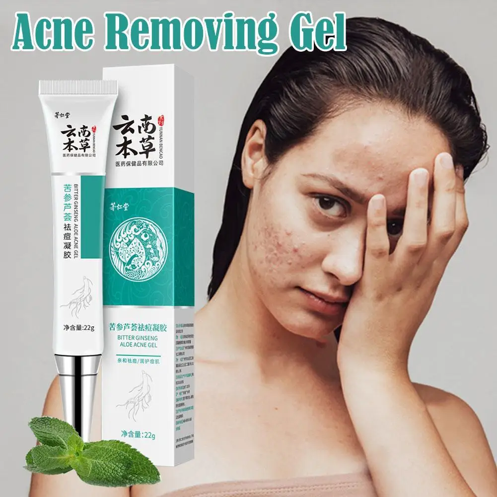 

Yunnan Herbal Anti Effective Acne Removal Cream Traditional Chinese Medicine Treatment Shrink Pores Spots Gel Whitening 22g