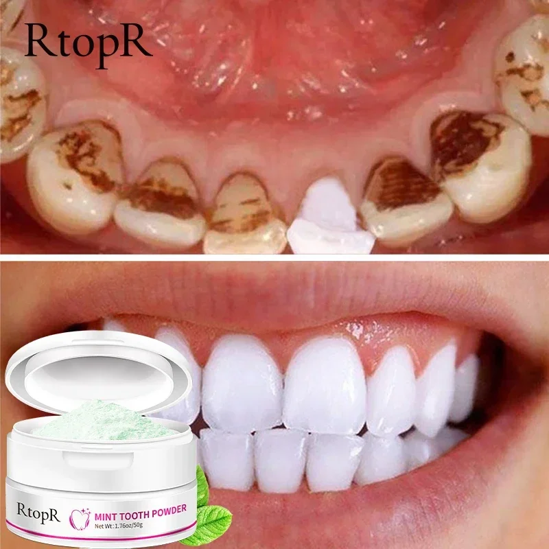 Teeth Whitening Powder Pearl Essence Natural Dental Toothpaste Toothbrush Kit Oral Hygiene For Remove Stains Plaque 55g
Teeth Whitening Powder Pearl Essence Natural Dental Toothpaste Toothbrush Kit Oral Hygiene For Remove Stains Plaque 55g