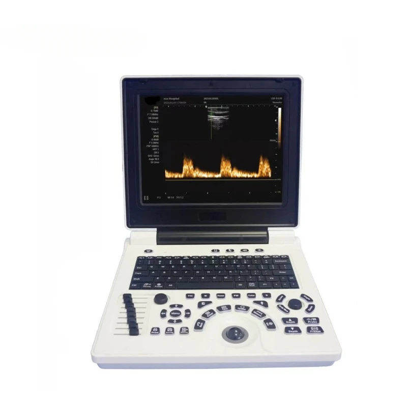 

New arrival PW black and white ultrasound scanner supports convex,transvaginal,linear and micro convex