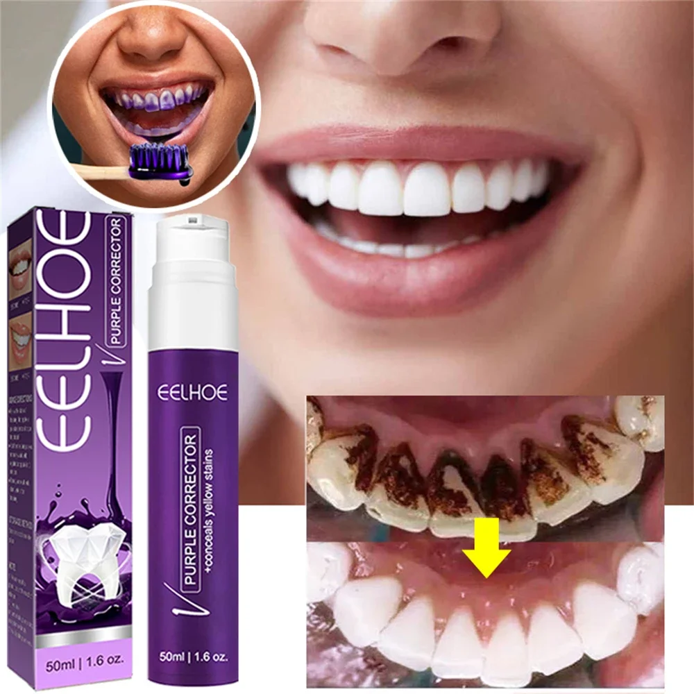 

Sdatter 50ml Purple Safe Whitening Toothpaste Refreshing Breath Teeth Foam Tooth Cleaning Mousse Plaque Removal Dentifrice Teeth