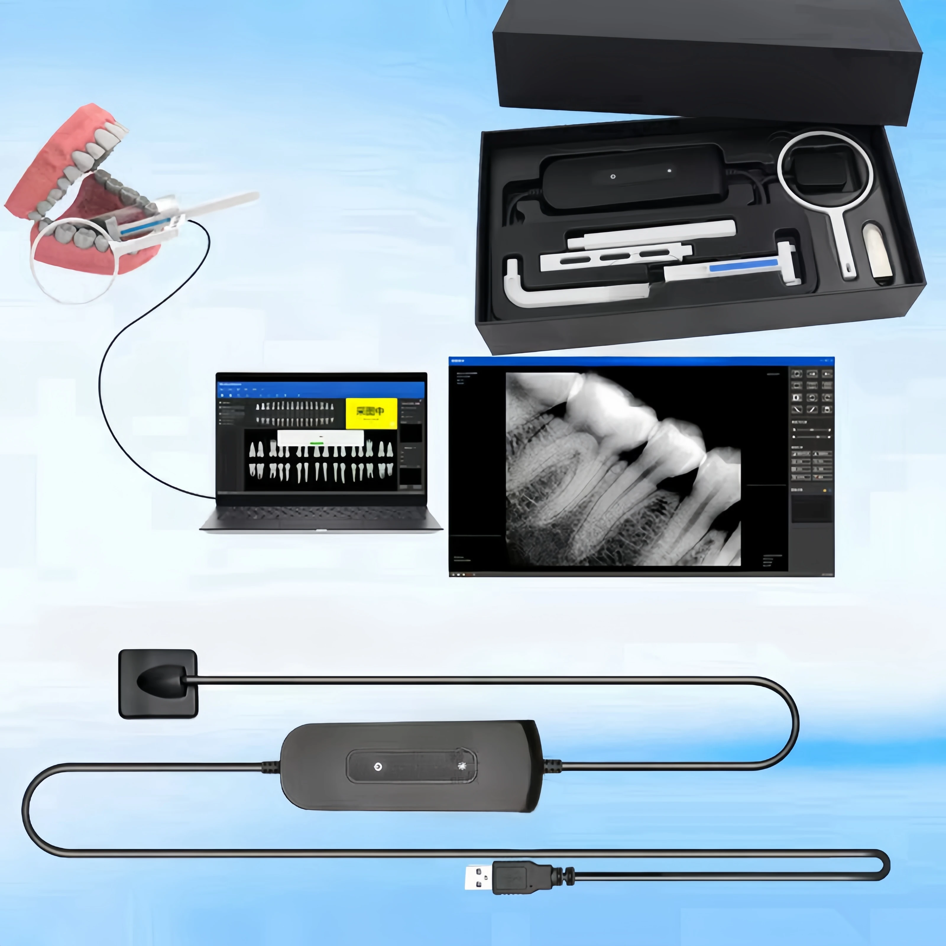 

Dentists Dental Sensor X-Ray High-Frequency Rx Digital Intraoral Digital System H D Image Radiovisografo Dentistry Implant Tools
