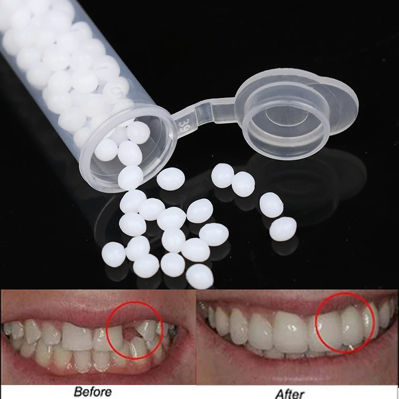 Temporary Tooth Repair Kit Teeth And Gaps False Solid Glue Denture Adhesive Whitening Beauty Tool | Красота и здоровье