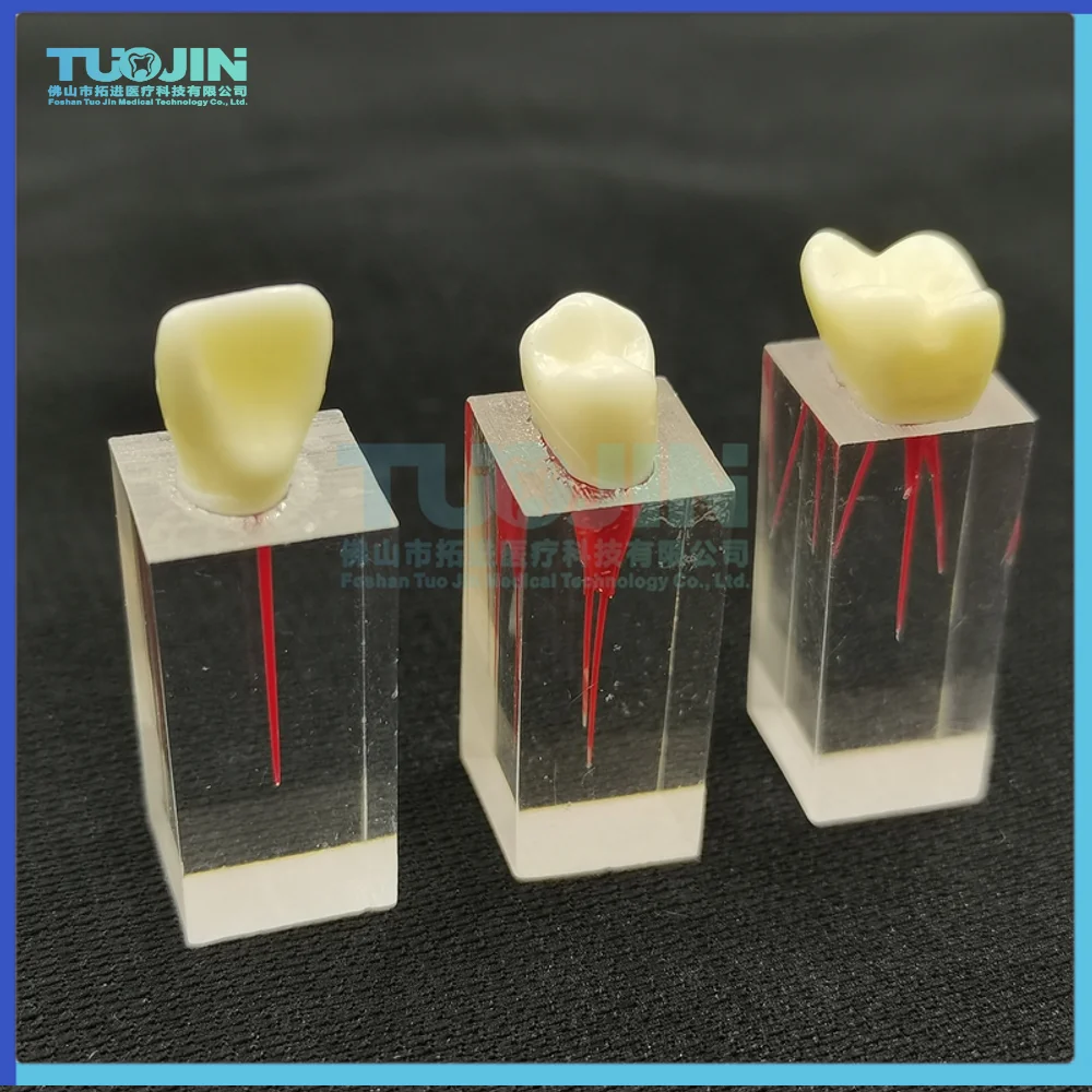 2PCS Dental Supplies Teeth Model Dentistry Root Canal Endodontic Treatment Tooth Model For Dentist Study Practice
2PCS Dental Supplies Teeth Model Dentistry Root Canal Endodontic Treatment Tooth Model For Dentist Study Practice