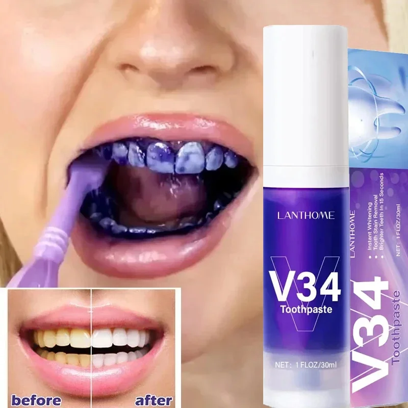 V34 Purple Teeth Whitening Toothpaste Tooth Care Gel Remove Plaque Stains Fresh Bad Breath Cleaning Oral Hygiene Dental Tools
V34 Purple Teeth Whitening Toothpaste Tooth Care Gel Remove Plaque Stains Fresh Bad Breath Cleaning Oral Hygiene Dental Tools