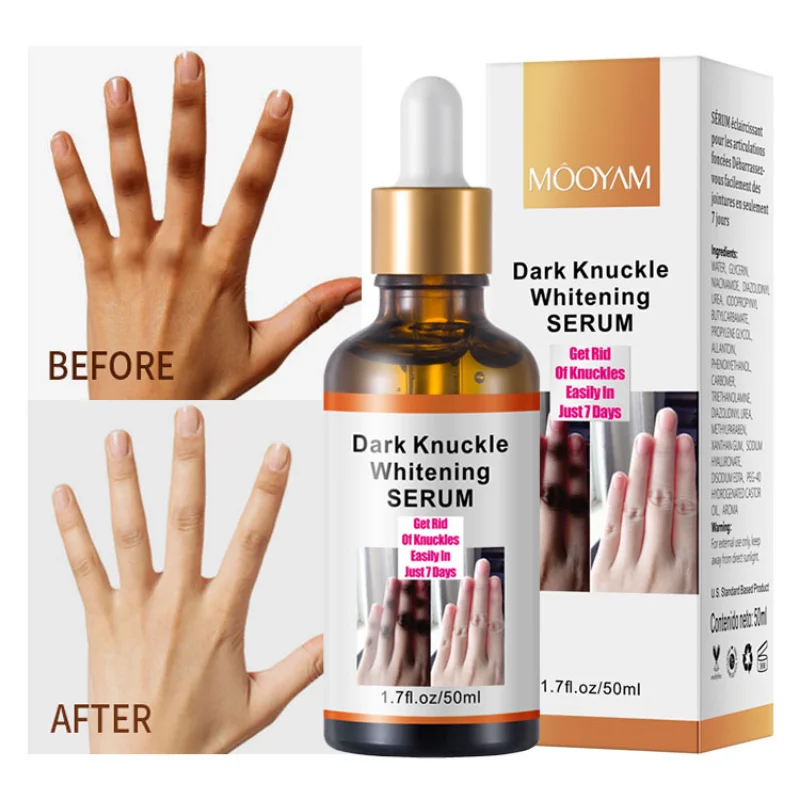 Dark Knuckles Fast Whitening Serum Pigmentation Correctors for Black Skin Hand Knuckle Elbows Knee Intense Stains Remover Serum
Dark Knuckles Fast Whitening Serum Pigmentation Correctors for Black Skin Hand Knuckle Elbows Knee Intense Stains Remover Serum