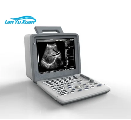 Hot Sale Cheap Price XF300 Full Digital LED Professional Therapy Portable Ultrasound Device
Hot Sale Cheap Price XF300 Full Digital LED Professional Therapy Portable Ultrasound Device