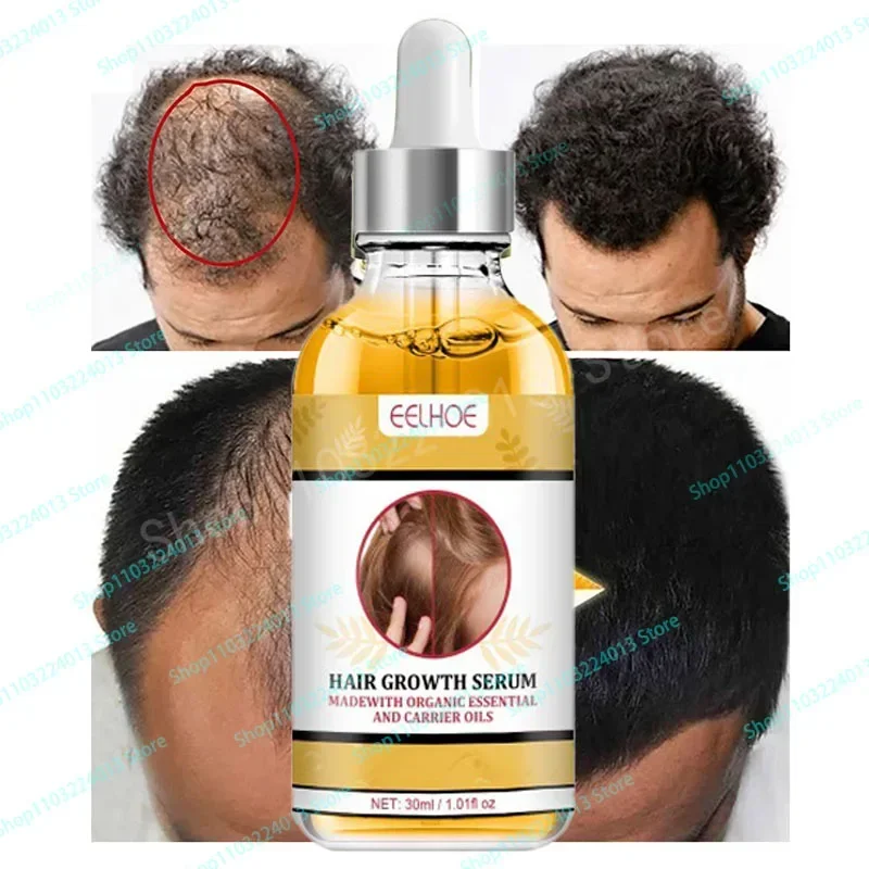 

Sdatter Hair Growth Products Prevent Hair Loss Essential Oil Fast Growing Anti-Drying Scalp Treatment Repair Beauty Health for M