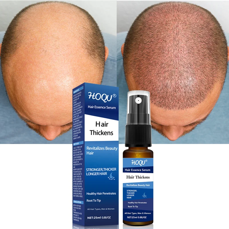 Hair Growth Product Anti Preventing Hair Loss Alopecia Liquid Damaged Hair Care Repair Growing Faster For Men Woman
Hair Growth Product Anti Preventing Hair Loss Alopecia Liquid Damaged Hair Care Repair Growing Faster For Men Woman