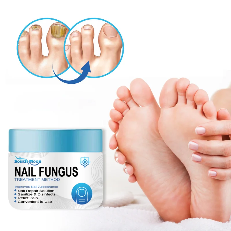 Nail Fungus Treatment Foot Repair Essence Toe Nail Fungus Removal Gel Anti Infection Paronychia Onychomycosis Cream Foot Care
Nail Fungus Treatment Foot Repair Essence Toe Nail Fungus Removal Gel Anti Infection Paronychia Onychomycosis Cream Foot Care