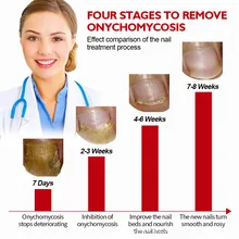 Feminine Hygiene Care Hand, Foot, Onychomycosis Care Liquid Brightening Soft Nail Bacteria Cleansing Nourishing Essential Oil
Feminine Hygiene Care Hand, Foot, Onychomycosis Care Liquid Brightening Soft Nail Bacteria Cleansing Nourishing Essential Oil