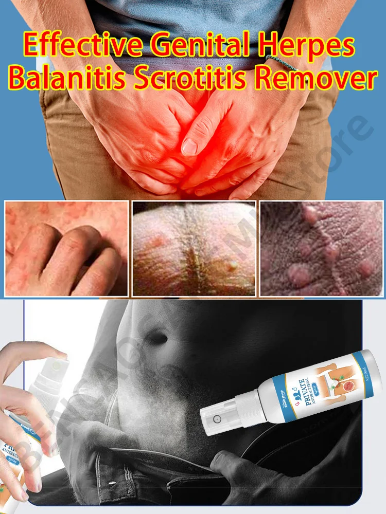 Effective Genital Herpes Remover Penile Herpes Blisters Ulcers Itching Balanitis Treatment Products Men Scrotitis Private Care 
Effective Genital Herpes Remover Penile Herpes Blisters Ulcers Itching Balanitis Treatment Products Men Scrotitis Private Care
