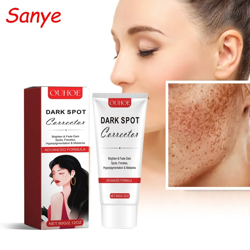 Face Chloasma Removal Cream For Women Remove Melasma Brighten Cream Facial Fade Dull Brightening Cream Dark Skin Lightening Care
Face Chloasma Removal Cream For Women Remove Melasma Brighten Cream Facial Fade Dull Brightening Cream Dark Skin Lightening Care