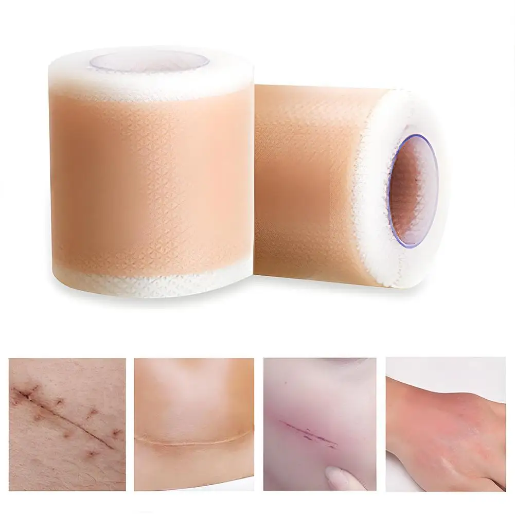 parche de Gel de silicona Lifting Facial para eliminar cicatrices, cinta de eliminación de cicatrices, Sección de quemaduras, cubierta de la piel, reparación de Trauma, oreja, acné, belleza, cicatriz, N8D7 12 parche de Gel de silicona Lifting Facial para eliminar cicatrices parche de Gel de silicona Lifting Facial para eliminar cicatrices, cinta de eliminación de cicatrices, Sección de quemaduras, cubierta de la piel, reparación de Trauma, oreja, acné, belleza, cicatriz, N8D7 » parche de Gel de silicona Lifting Facial para eliminar cicatrices