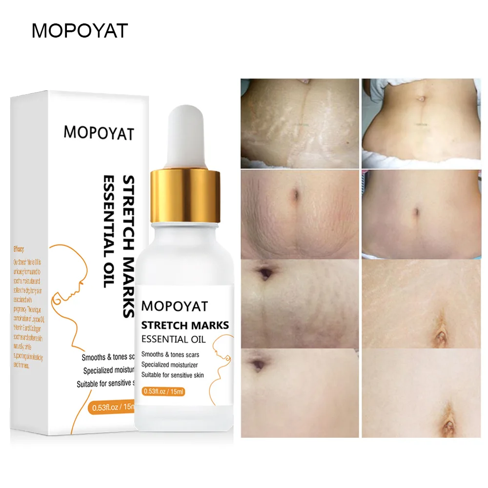 Scar Repair Oil Remove Pregnancy Scars Essential Oil Stretch Mark Treatment Maternity Repair Anti-Winkle Firming Body Care
Scar Repair Oil Remove Pregnancy Scars Essential Oil Stretch Mark Treatment Maternity Repair Anti-Winkle Firming Body Care