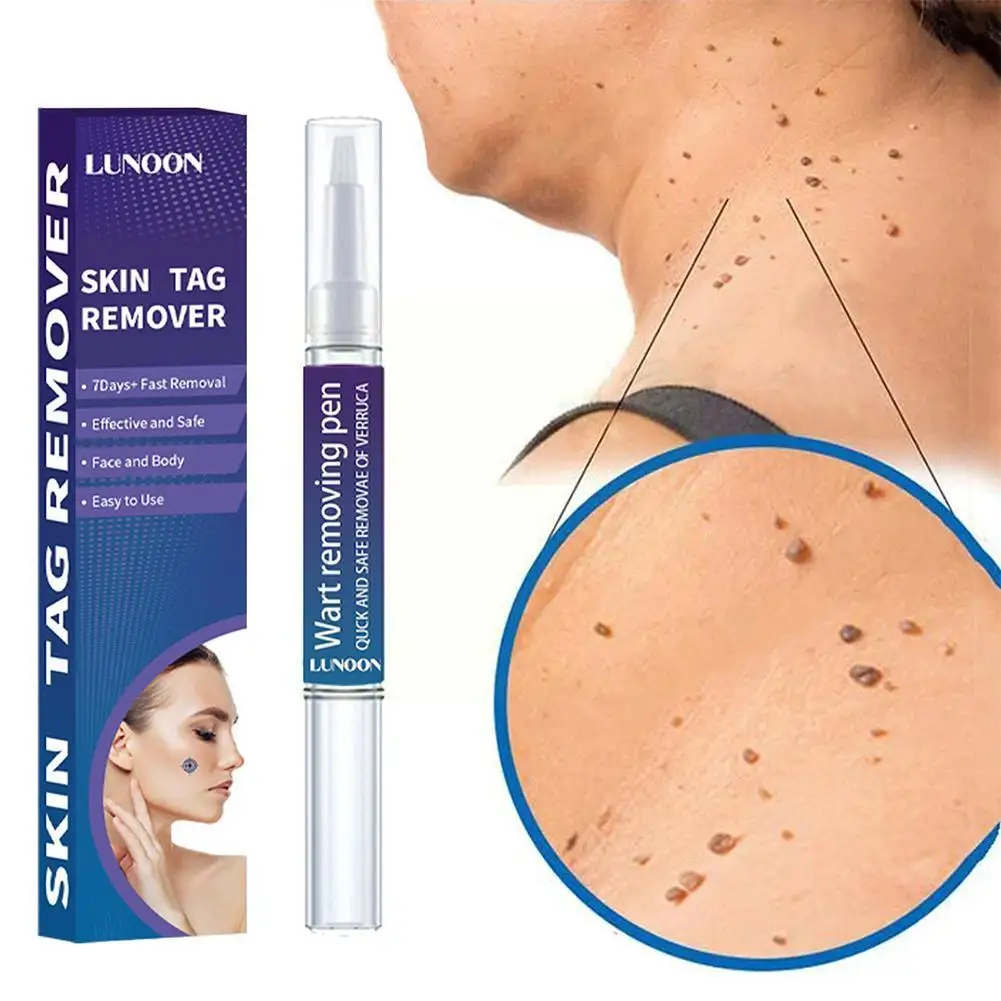 Ke You Liquid Pen Ke You Removing Chicken Eyes Flesh Flat Skin Ke Warts You Plantar Removing Granules Nevi Cream Spot I3X0
Ke You Liquid Pen Ke You Removing Chicken Eyes Flesh Flat Skin Ke Warts You Plantar Removing Granules Nevi Cream Spot I3X0